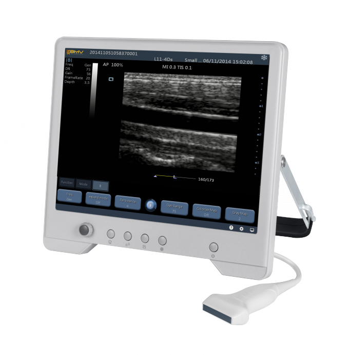 Система ультразвука ТС20 цифров диагностическая для отдела акушерства и Гынекологы